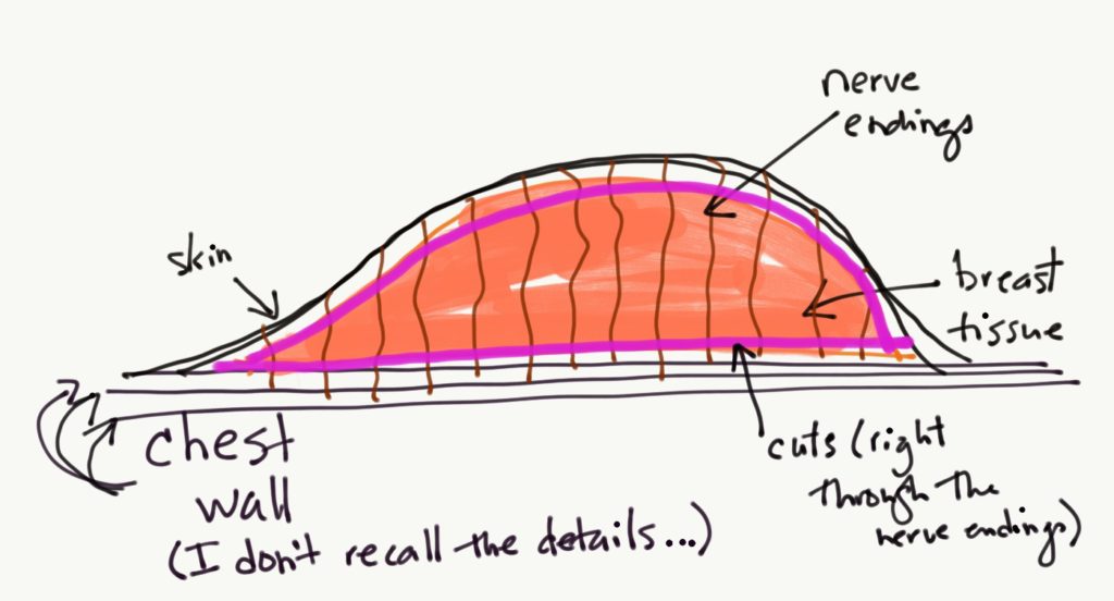 chest diagram. 