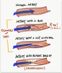 Types of Arteries